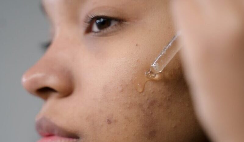 Galleria foto '7 Proprietà dell’Olio di Cocco: i benefici per Pelle e Capelli che forse non conosci' - foto 1