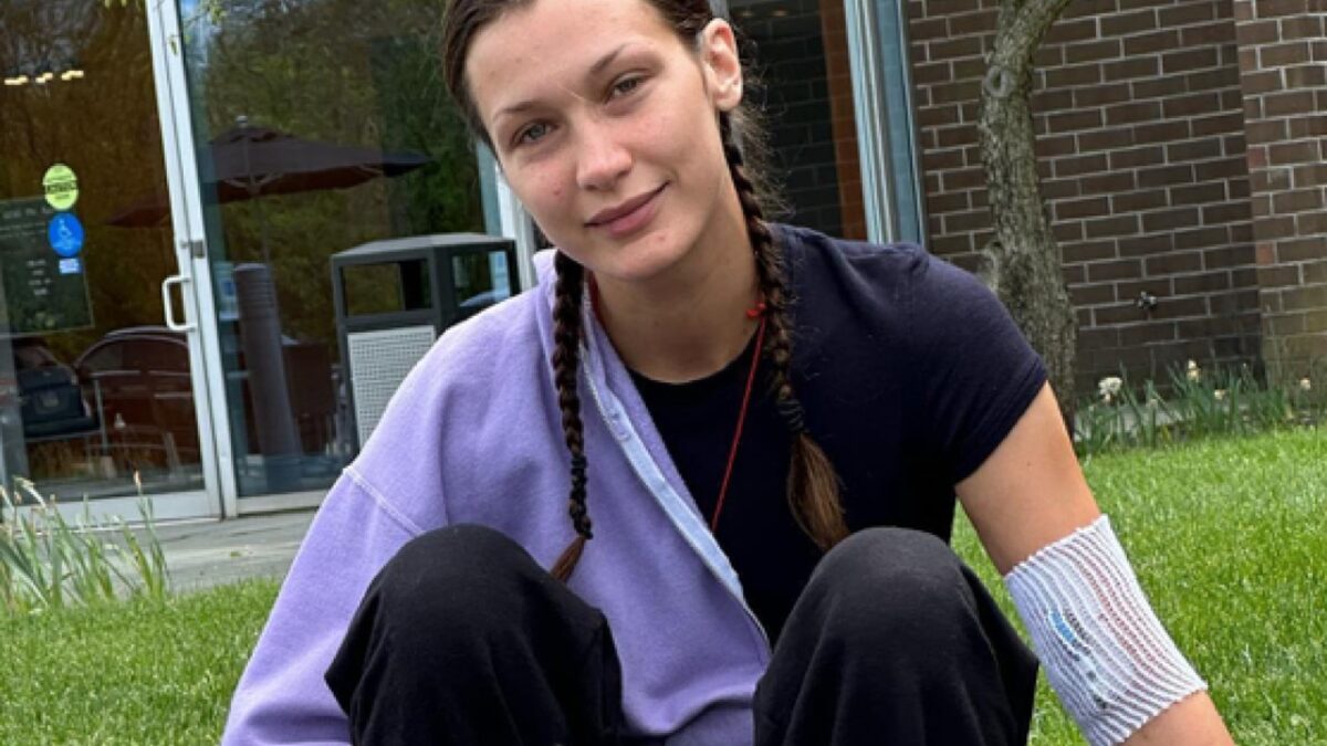 Bella Hadid annuncia di essere guarita dalla Malattia di Lyme dopo 10 anni di cure!