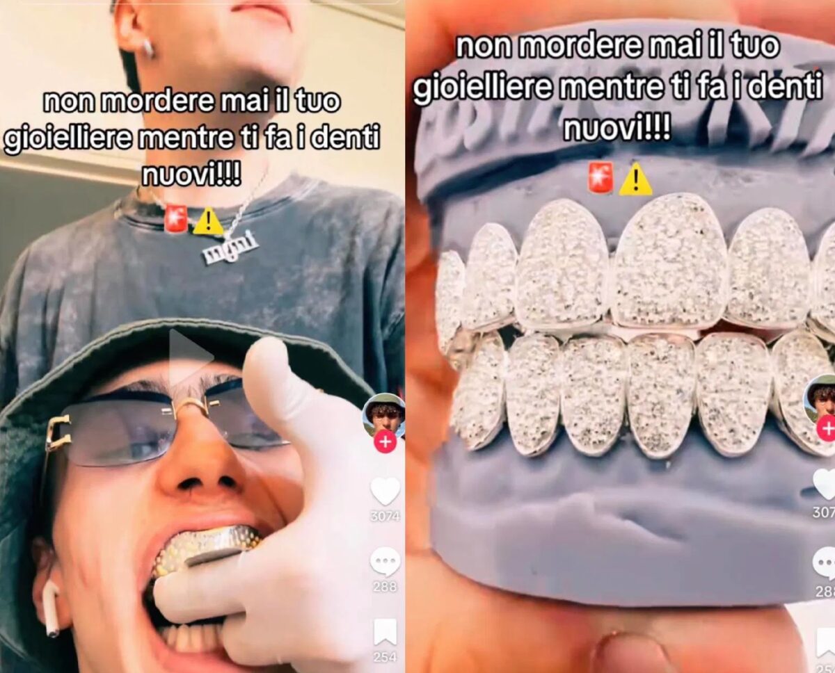 Galleria foto 'Achille Costacurta, il figlio di Martina Colombari mostra i nuovi denti tempestati di diamanti!' - foto 1