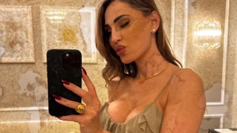 Anna Tatangelo, neppure in gravidanza rinuncia allo stile più sparkling: ecco il Look sfoggiato a Battiti Live